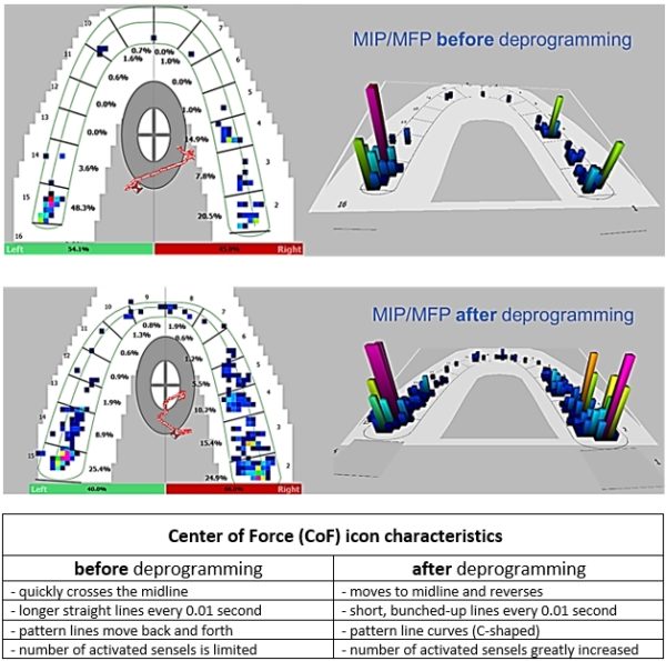 Before and afterr MIP-MFP frames with CoF icon characteristics